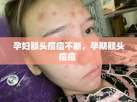 孕妇额头痘痘不断，孕期额头痘痘 