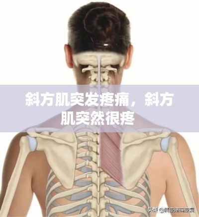 斜方肌突发疼痛，斜方肌突然很疼 