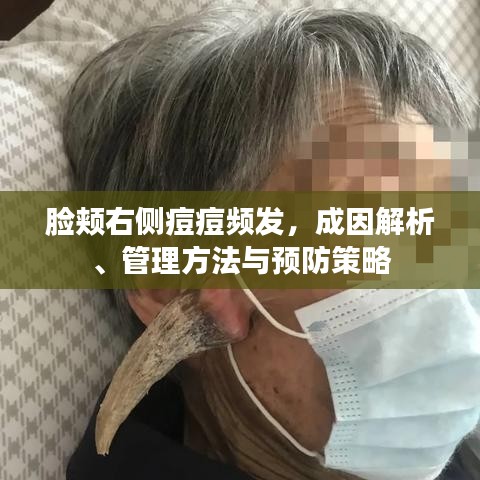 脸颊右侧痘痘频发，成因解析、管理方法与预防策略