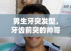 男生牙突发型，牙齿前突的帅哥 