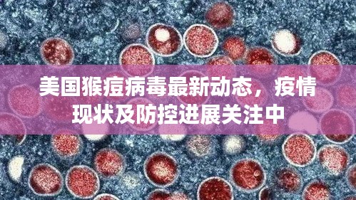 美国猴痘病毒最新动态，疫情现状及防控进展关注中