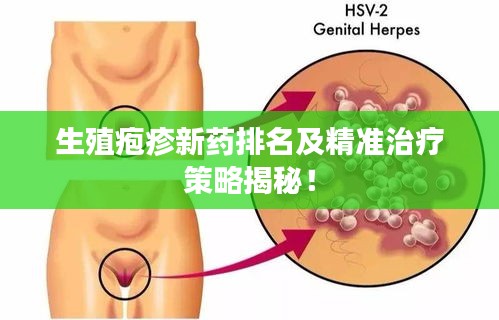 生殖疱疹新药排名及精准治疗策略揭秘！