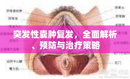 突发性囊肿复发，全面解析、预防与治疗策略
